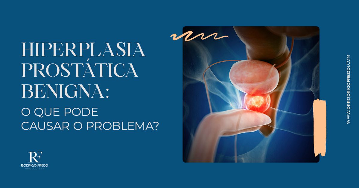 Hiperplasia Prostática Benigna O Que Pode Causar O Problema Dr