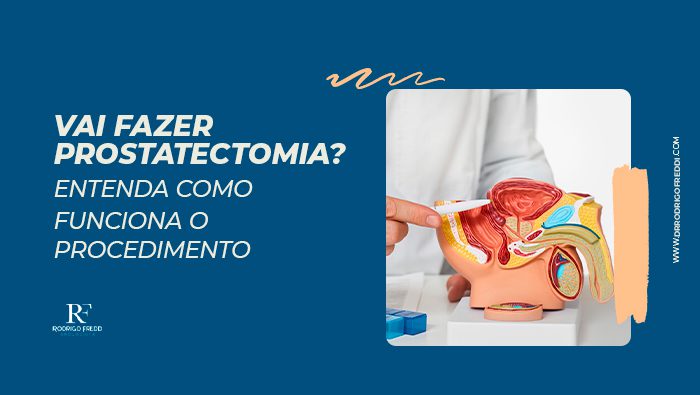 vai fazer prostatectomia entenda como funciona o procedimento dr rodrigo freddi bg