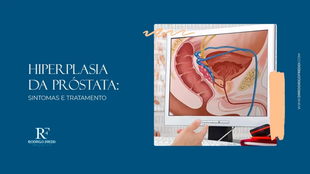 A imagem contém o título do vídeo 'Hiperplasia da próstata: Sintomas e tratamento' do lado esquerdo, e ao lado direito mostra um monitor de computador com um desenho da estrutura de uma próstata.