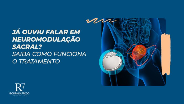 ja ouviu falar em neuromodulacao sacral saiba como funciona o tratamento dr rodrigo freddi bg