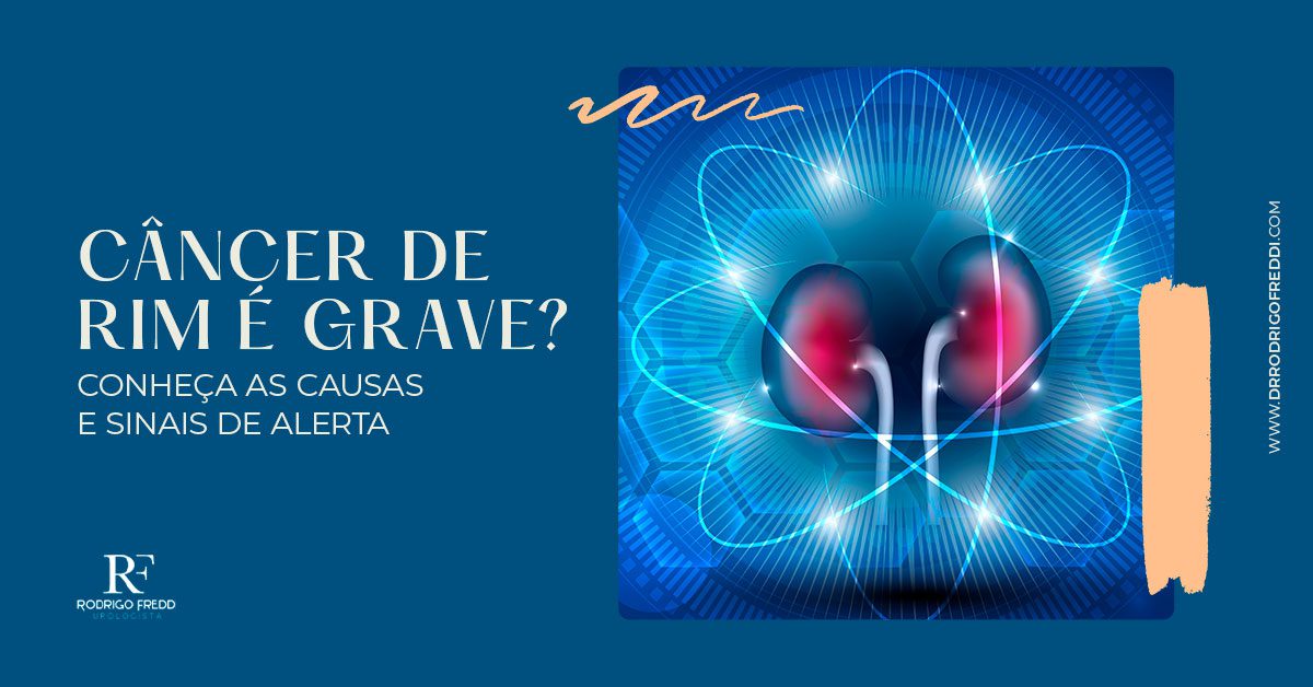 Câncer de rim é grave? Conheça as causas e sinais de alerta - Dr ...