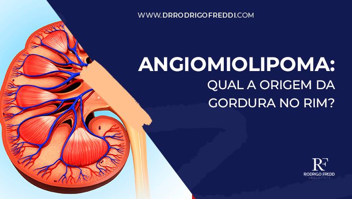 Ilustração médica detalhada de um rim humano, destacando a estrutura interna com vasos sanguíneos em azul e vermelho, usada para explicar a anatomia e condições renais.