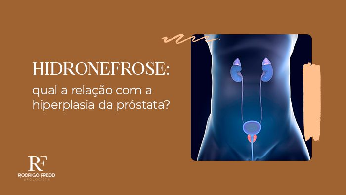 hidronefrose qual a relacao com a hiperplasia da prostata blog