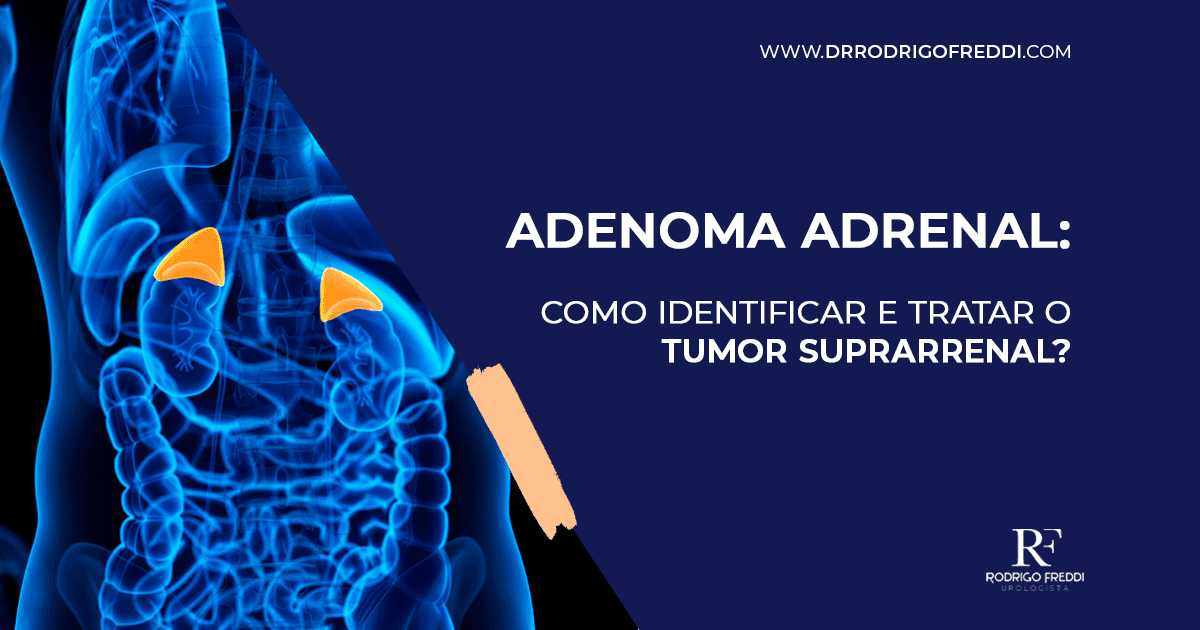 Adenoma Suprarrenal Tratamiento – DUZNS