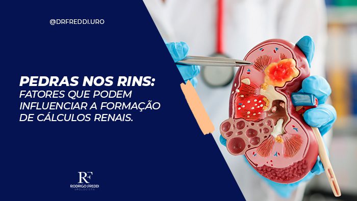 Imagem de um médico segurando um modelo anatômico de rim com cálculos renais, destacando a formação de pedras e suas localizações, utilizado para explicar problemas renais.